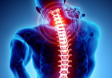 Neck Pain | Brisbane City Physiotherapy